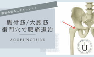 腰痛に関連が深い腸腰筋と衝門穴